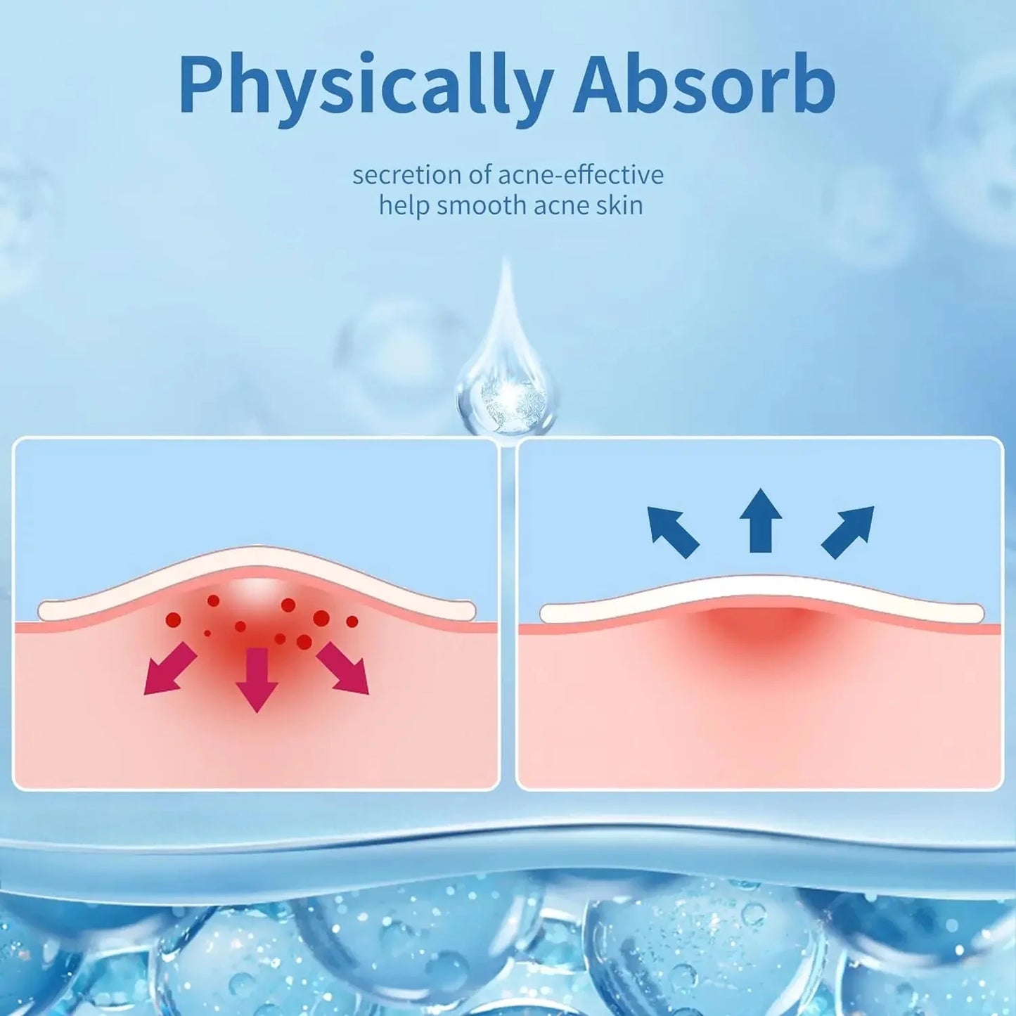 Invisible Acne Patches – Oil Control, Pore Cleansing & Skin Repair Stickers